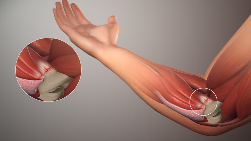 illustration of the inside of a human elbow